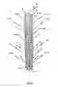 Fig. 07 - Endoprosthesis for implantation in the heart of a patient