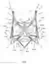 Fig. 10 - Endoprosthesis for implantation in the heart of a patient