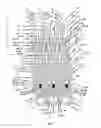 Fig. 13 - Endoprosthesis for implantation in the heart of a patient