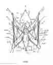 Fig. 14 - Endoprosthesis for implantation in the heart of a patient