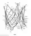 Fig. 15 - Endoprosthesis for implantation in the heart of a patient