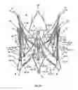 Fig. 18 - Endoprosthesis for implantation in the heart of a patient