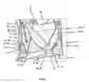Fig. 24 - Endoprosthesis for implantation in the heart of a patient