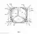 Fig. 26 - Endoprosthesis for implantation in the heart of a patient