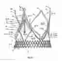 Fig. 28 - Endoprosthesis for implantation in the heart of a patient