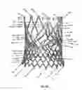 Fig. 47 - Endoprosthesis for implantation in the heart of a patient
