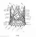 Fig. 52 - Endoprosthesis for implantation in the heart of a patient
