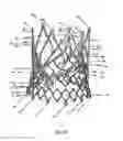 Fig. 53 - Endoprosthesis for implantation in the heart of a patient