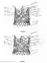 Fig. 57 - Endoprosthesis for implantation in the heart of a patient