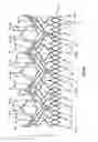 Fig. 61 - Endoprosthesis for implantation in the heart of a patient