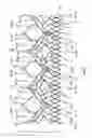 Fig. 62 - Endoprosthesis for implantation in the heart of a patient