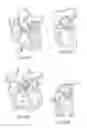 Fig. 03 - ENDOLUMINAL CARDIAC AND VENOUS VALVE PROSTHESES AND METHODS OF MANUFACTURE AND DELIVERY THEREOF