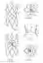 Fig. 05 - ENDOLUMINAL CARDIAC AND VENOUS VALVE PROSTHESES AND METHODS OF MANUFACTURE AND DELIVERY THEREOF