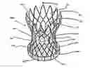 Fig. 01 - Aortic replacement valve