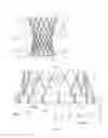 Fig. 02 - Aortic replacement valve