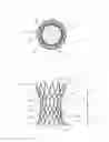 Fig. 03 - Aortic replacement valve