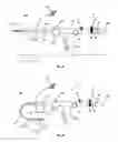 Fig. 04 - Catheter system for introducing an expandable heart valve stent into the body of a patient, insertion system with a catheter system and medical device for treatment of a heart valve defect