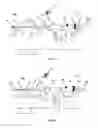 Fig. 07 - Catheter system for introducing an expandable heart valve stent into the body of a patient, insertion system with a catheter system and medical device for treatment of a heart valve defect