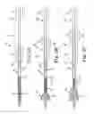 Fig. 04 - Transcatheter prosthetic heart valve delivery system with recapturing feature and method