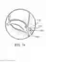 Fig. 09 - Devices and methods for treating valvular regurgitation