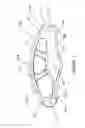 Fig. 02 - Implantable spinal insert system