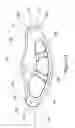 Fig. 04 - Implantable spinal insert system