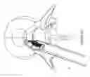 Fig. 10 - Implantable spinal insert system