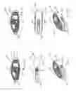 Fig. 16 - Implantable spinal insert system