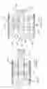 Fig. 20 - Implantable spinal insert system