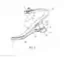 Fig. 02 - Prosthetic foot including a heel cap and interchangeable heel-side spring-damper