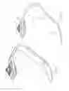 Fig. 13 - Jointless prosthetic foot