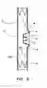 Fig. 06 - Stent graft with fenestration