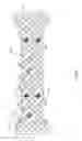Fig. 02 - RADIOACTIVE STENT