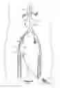 Fig. 07 - Endograft delivery device assembly