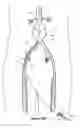 Fig. 08 - Endograft delivery device assembly
