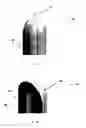 Fig. 06 - Gastric device and method of use thereof