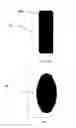 Fig. 12 - Gastric device and method of use thereof