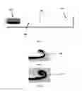 Fig. 19 - Gastric device and method of use thereof