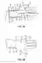 Fig. 04 - Disposable tape kit and method for wrist immobilization