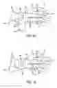 Fig. 09 - Disposable tape kit and method for wrist immobilization