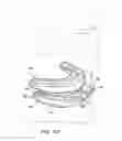 Fig. 13 - Apparatus for Improved Breathing