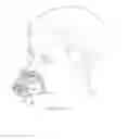 Fig. 26 - Apparatus for Improved Breathing