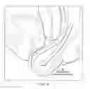 Fig. 05 - Flexible cone-shaped intra-vaginal support device