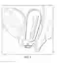 Fig. 06 - Flexible cone-shaped intra-vaginal support device