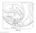 Fig. 14 - Flexible cone-shaped intra-vaginal support device