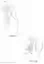Fig. 16 - Flexible cone-shaped intra-vaginal support device