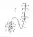 Fig. 02 - Catheter System with On-Board Temperature Probe