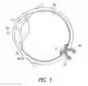 Fig. 02 - Pressurized goggle for physiological monitoring or intraocular pressure modification