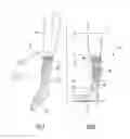 Fig. 02 - Elastic venous compression orthosis