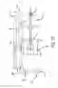 Fig. 06 - Surgical frame facilitating articulatable support for a patient during surgery